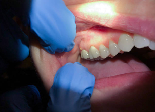 Best Broken or Chipped Tooth Repair in Seabrook, MD