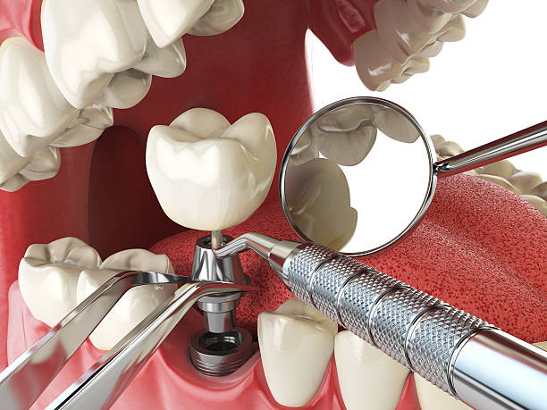 Best Emergency Treatment for Oral Infections in Seabrook, MD